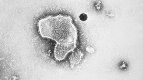 This 1981 photo provided by the Centers for Disease Control and Prevention (CDC) shows an electron micrograph of Respiratory Syncytial Virus, also known as RSV. (CDC via AP)