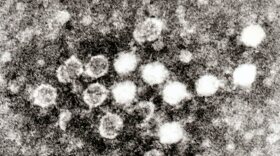 Electron micrograph of negatively stained Parvovirus B19 in blood. Each virus particle is about 25 to 30nM in diameter. Graham Beards at English Wikipedia, CC BY 3.0 <https://creativecommons.org/licenses/by/3.0>, via Wikimedia Commons